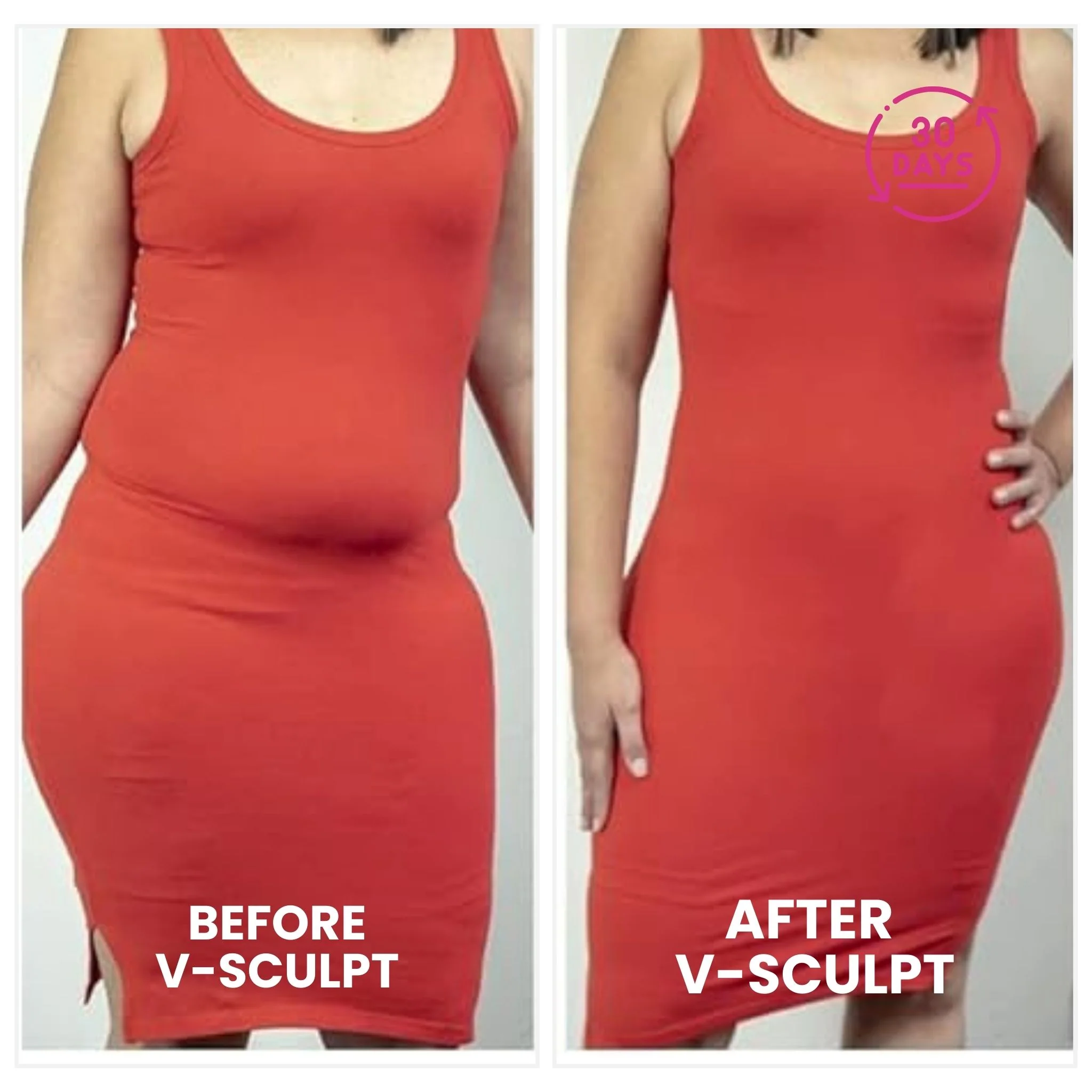 V-Sculpt | Confidence, Shape & Lift - Image 4
